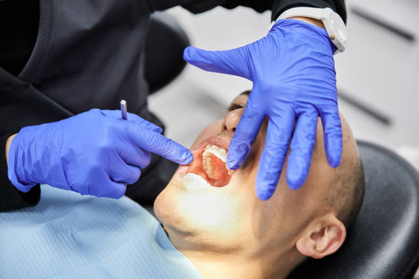 Best Dentist for Tooth Abscess  in West Ack, NY